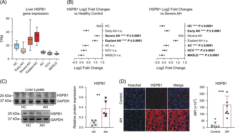 Evidence that extracellular HSPB1 contributes to inflammation in alcohol-associated hepatitis.