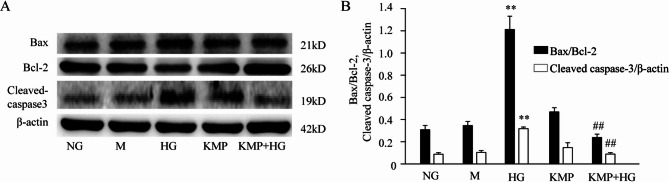 The protective effect of kaempferol on high glucose-stimulated renal tubular epithelial cells.