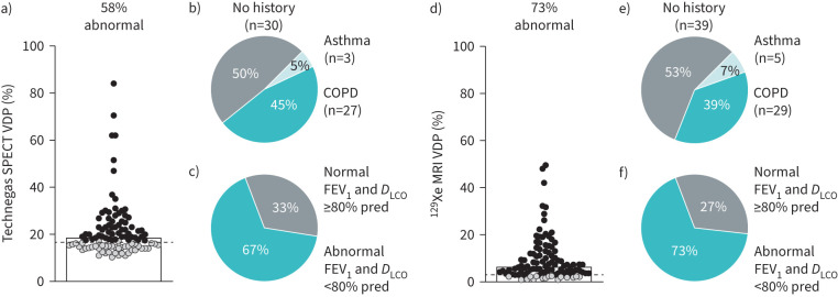 Ventilation defect burden predicts lung cancer resection outcomes.