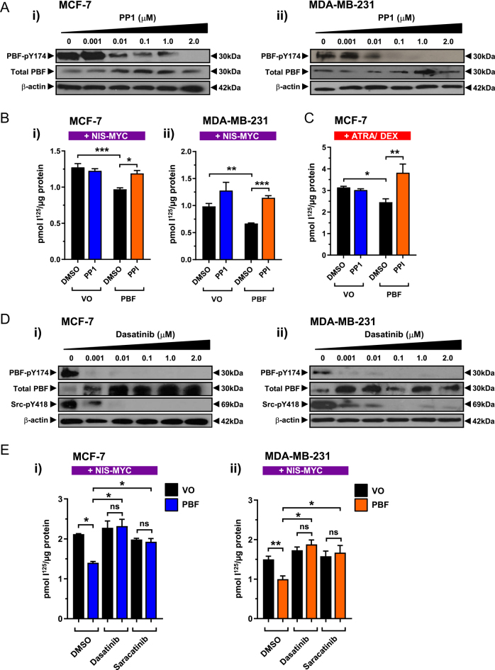 Targeting Src tyrosine kinase to enhance radioiodide uptake in breast cancer.
