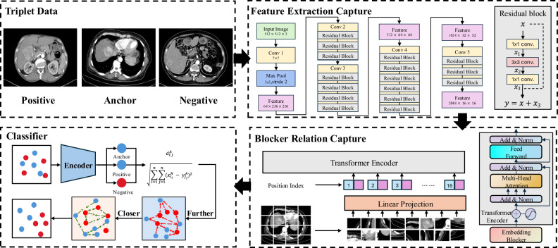 Macrotrabecular-massive subtype in hepatocellular carcinoma based on contrast-enhanced CT: deep learning outperforms machine learning.