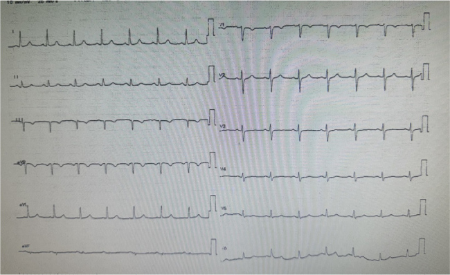 Spontaneous Aortic Sealing with Tranexamic Acid in Type A Dissection: A Novel Life-Saving Finding.