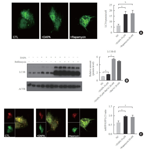 Sodium-Glucose Cotransporter-2 Inhibitor Enhances Hepatic Gluconeogenesis and Reduces Lipid Accumulation via AMPK-SIRT1 Activation and Autophagy Induction.