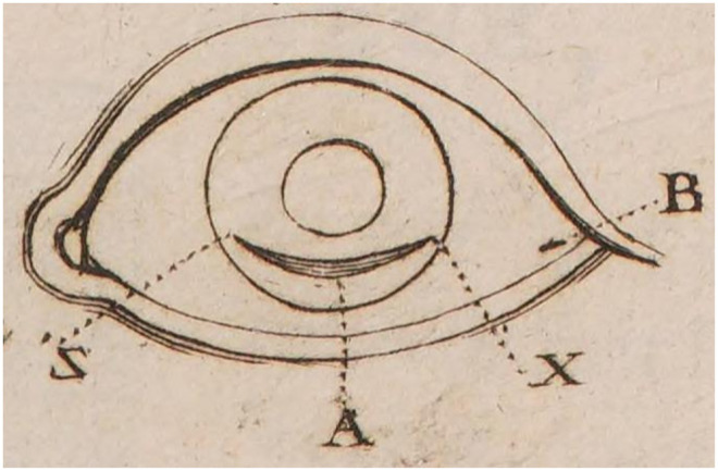 Jacques Daviel (1696-1762) and the Competition to Extract Cataracts: A Reappraisal.