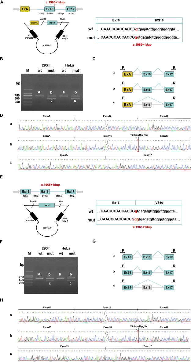 Unraveling the pathogenicity role of the novel compound heterozygous mutations of MED25 gene in a Chinese patient with BVSYS.