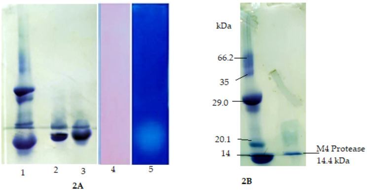 Novel thrombolytic protease from the rare halophile Brachybacterium paraconglomeratum: bioprocessing and in vitro application.