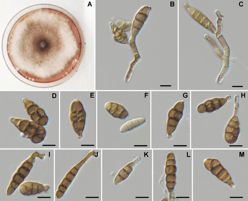 ﻿ <i>Alternariaphoenicis</i> sp. nov. and <i>Alternariaouedrighensis</i> sp. nov. (Pleosporales, Pleosporaceae): Two new species associated with leaf spot and blight diseases of date palm (<i>Phoenixdactylifera</i> L.).