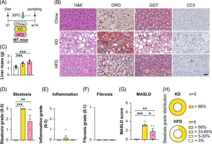 Adipocyte-specific deletion of gp130 prevents ketogenic diet-induced hepatic steatosis.