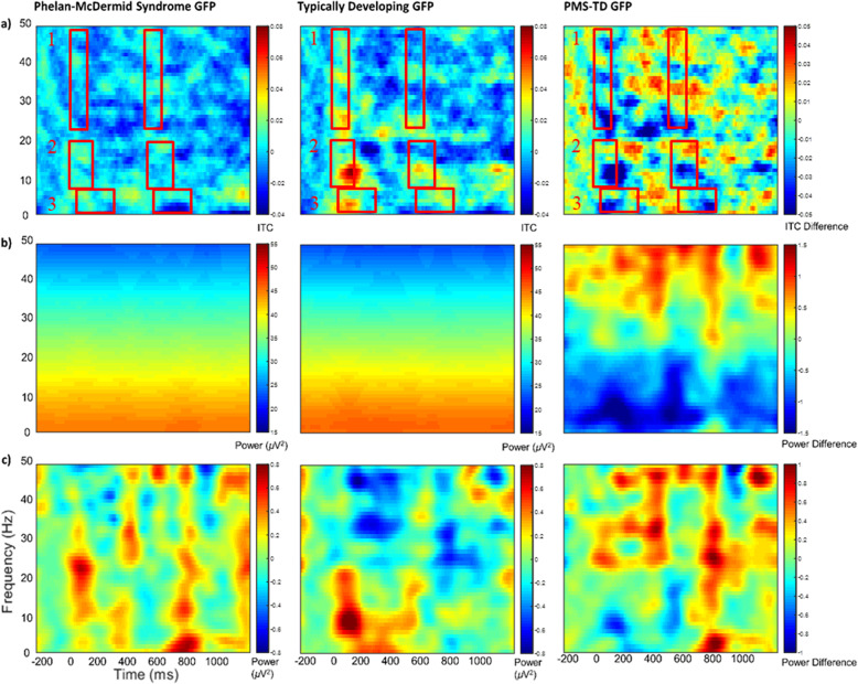 Phenotypic variation in neural sensory processing by deletion size, age, and sex in Phelan-McDermid syndrome.