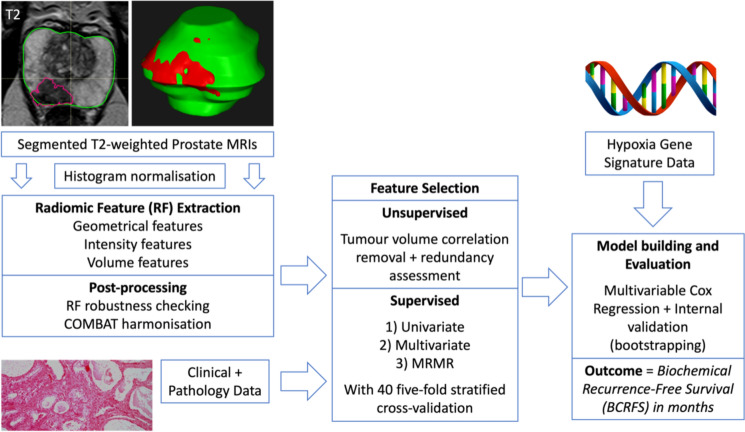 Combining MRI radiomics, hypoxia gene signature score and clinical variables for prediction of biochemical recurrence-free survival after radiotherapy in prostate cancer.