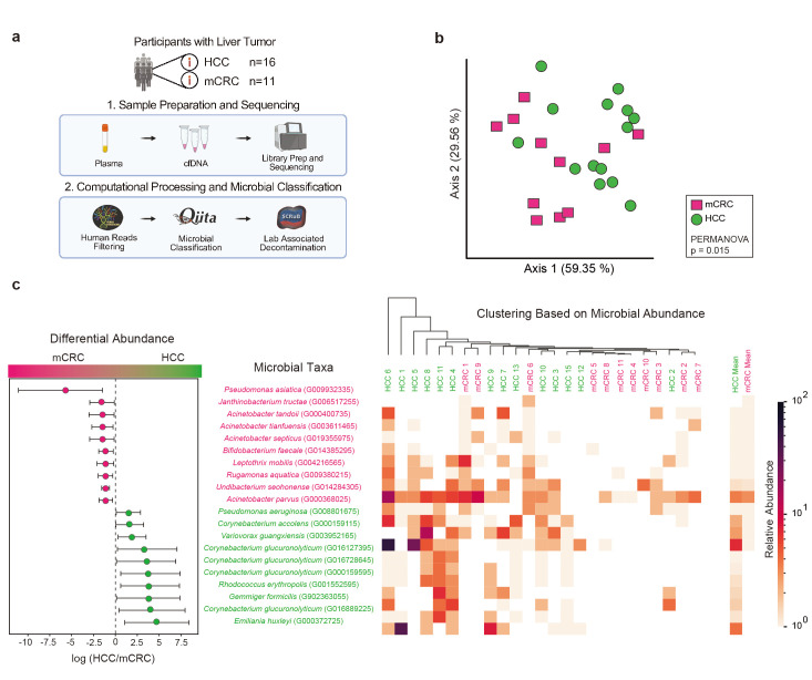 Blood microbial DNA signature differentiates hepatocellular carcinoma from metastatic lesions.