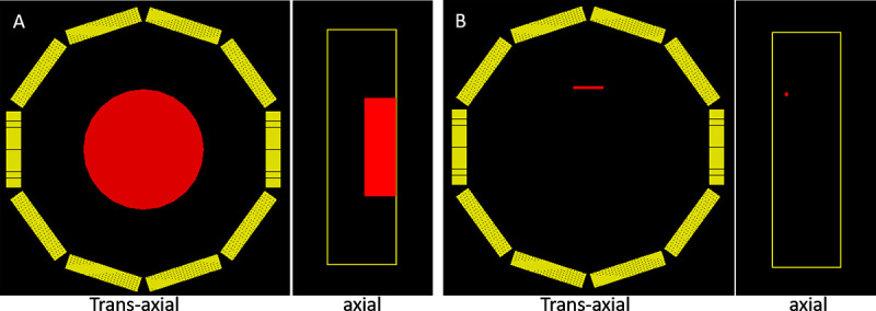 Effect of Span and MRD Configurations on Small Animal PET Image Quality and Quantitative Accuracy.