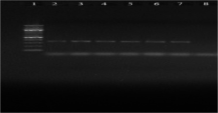 Detection and antimicrobial susceptibility of E. coli O157:H7 in the milk supply chain, milking environments and humans in Woliata Sodo, Ethiopia.