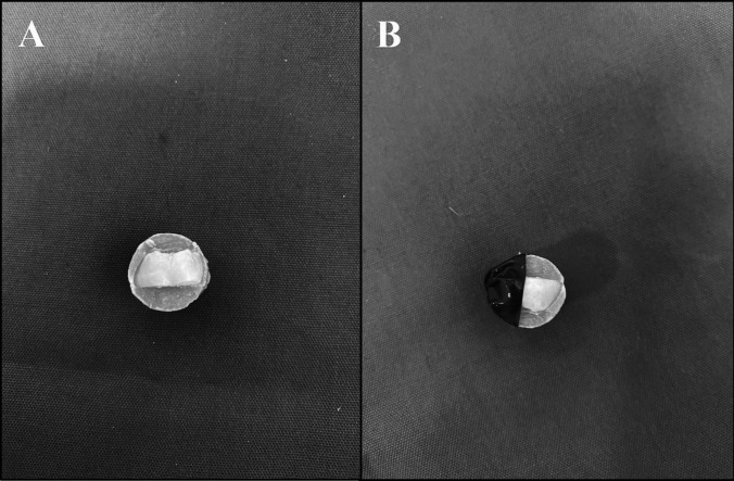 Impact of prophylaxis pastes and application techniques on immature enamel surface roughness: an in-vitro study.