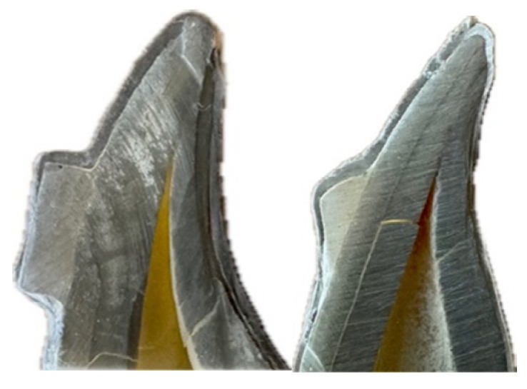 Evaluation of Compatibility of Different Attachment Types Used in Orthodontic Clear Aligners with Electron Microscopy.