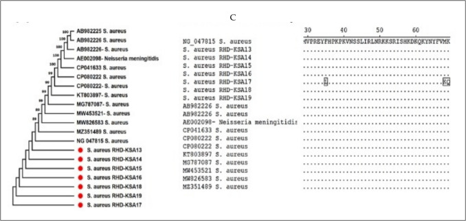 Prevalence, toxin virulence genes and investigating the effect of mutations in the tetracycline gene (tetK) on the response of methicillin-resistant Staphylococcus aureus to antibiotics: a study in sickle cell disease patients in Riyadh, Saudi Arabia.