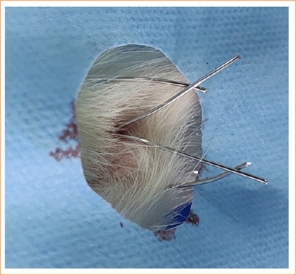 A standardized protocol for anal fistula induction in a rat model.