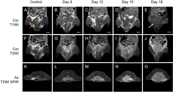 The dynamic changes in quantitative parameters of diffusion-weighted imaging at different b-values in a prostate cancer mouse model and their correlation with histopathology parameters.