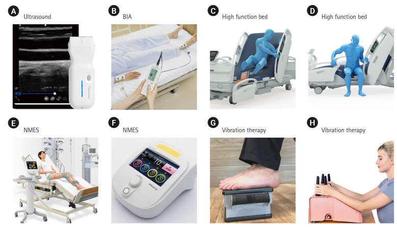 Intensive care unit-acquired muscle atrophy and weakness in critical illness: a review of long-term recovery strategies.