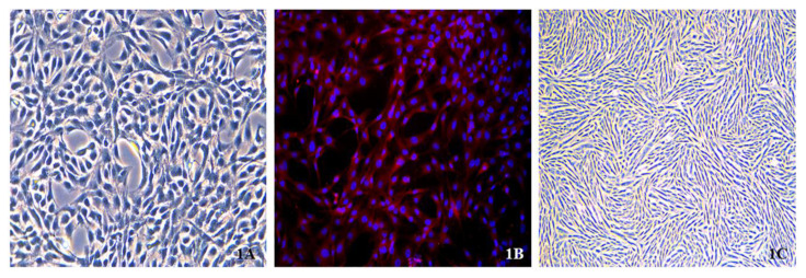 Analysis of Gene Expression Profiles Regulating Phenotypic Transformation of Vascular Smooth Muscle Cells by Endothelial Cell-Derived Exosomes.