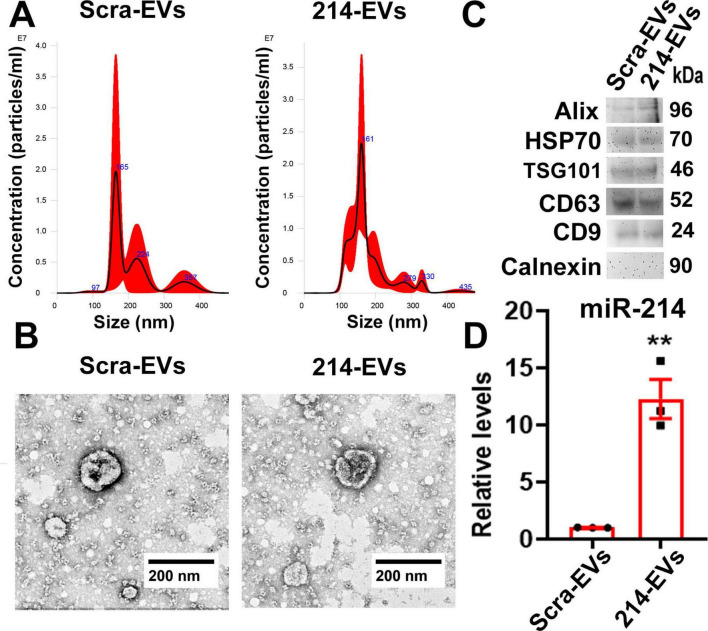 Engineered miR-214 enriched Schwann cell-derived extracellular vesicles amplify therapeutic efficacy for peripheral neuropathy in T2D mice.