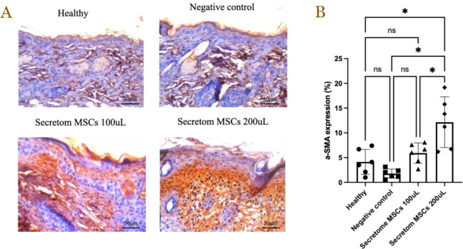 Mesenchymal stem cell-derived secretome accelerates third-degree burn wound healing: Effects on proliferation, angiogenesis, and fibrosis regulation.