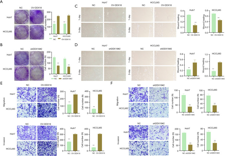 DDX18 promotes growth and metastasis of hepatocellular carcinoma via activating EMT and MAPK signaling.