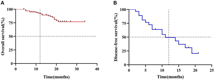 Neoadjuvant immunochemotherapy for resectable esophageal cancer: A study on efficacy and safety.