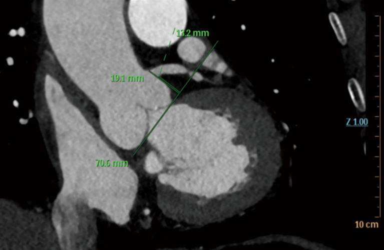 Digital clinical teaching of cardiovascular surgery supported by precision imaging and 3D printing technology: a randomized parallel-controlled trial.