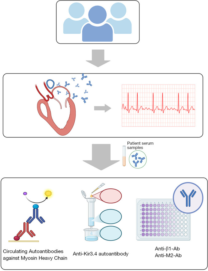 Autoimmune antibodies in arrhythmia: a narrative review of potential therapeutic targets to prevent overtreatment.