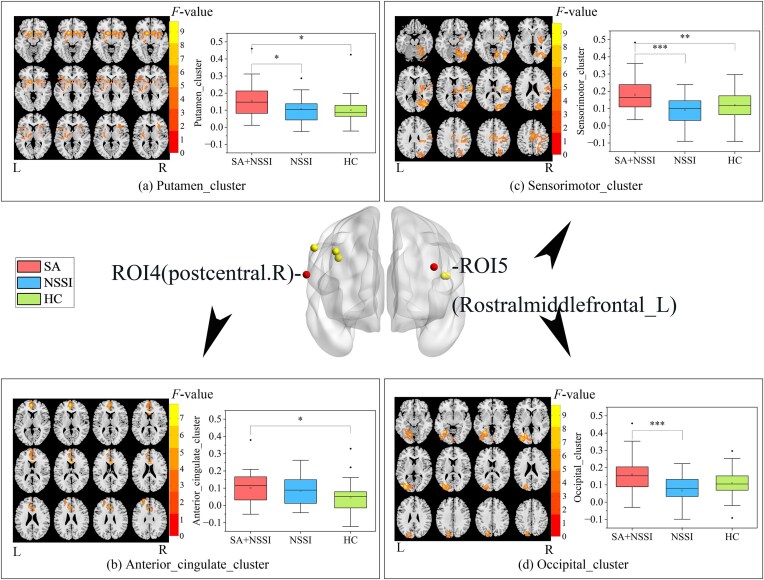 Altered local gyrification index and corresponding functional connectivity in female depressed adolescents with suicide attempts and non-suicidal self-injury.