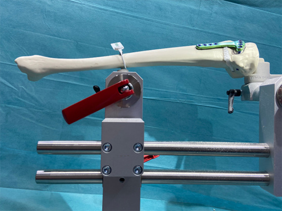 Do monocortical distal locking screws impair mechanical properties in opening wedge high tibial osteotomy with bone graft?-a sawbone biomechanical study.