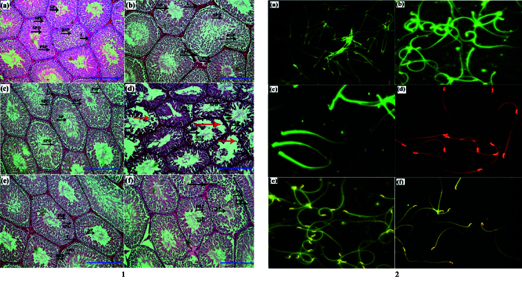 Protective effects of Spirulina platensis and phycocyanin on sperm quality, DNA integrity, and testicular tissue following oxidative stress in rats: An experimental study.