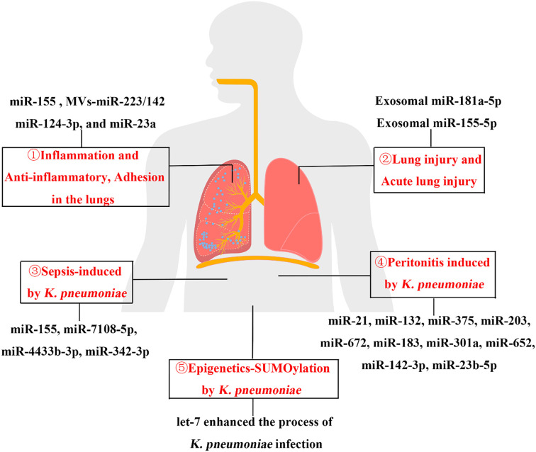 Function and mechanism of miRNAs during the process of <i>Klebsiella pneumoniae</i> infection: A review.