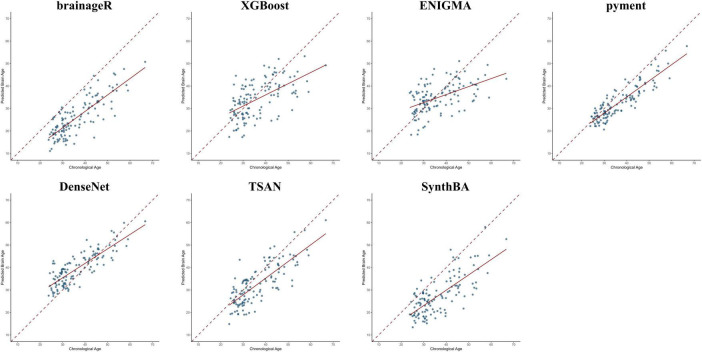 Association between shift work and brain age gap: a neuroimaging study using MRI-based brain age prediction algorithms.