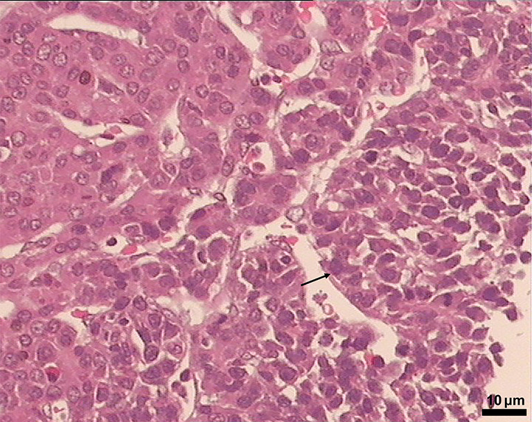 Clinical phenotype and molecular genetic analysis of 24 cases of Beckwith-Wiedemann syndrome.