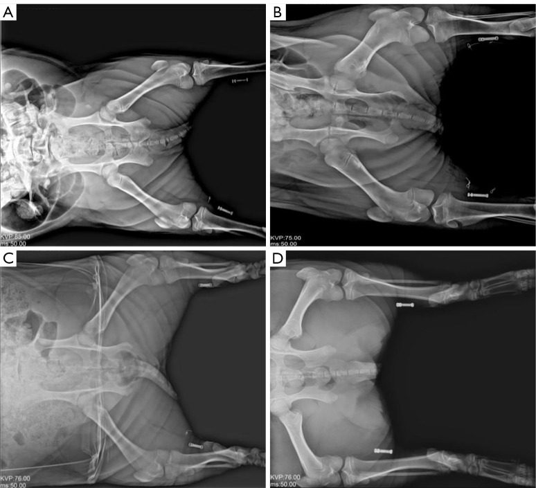 Effect of a novel implantable tibial nerve stimulation system on overactive bladder in pigs.