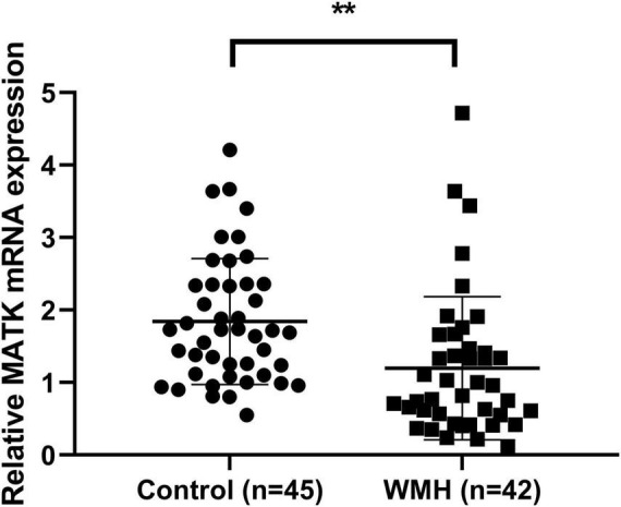 The expression and association of MATK in chronic hypoperfusion patients with white matter hyperintensity.
