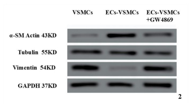 Analysis of Gene Expression Profiles Regulating Phenotypic Transformation of Vascular Smooth Muscle Cells by Endothelial Cell-Derived Exosomes.