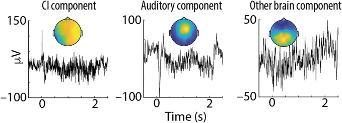 Neural alpha oscillations and auditory steady-state responses during adaptation to a cochlear implant.