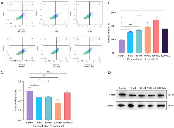 Investigation into the sensitivity of adipocytes mediated by the major vault protein (MVP) to chemotherapy for triple-negative breast cancer.