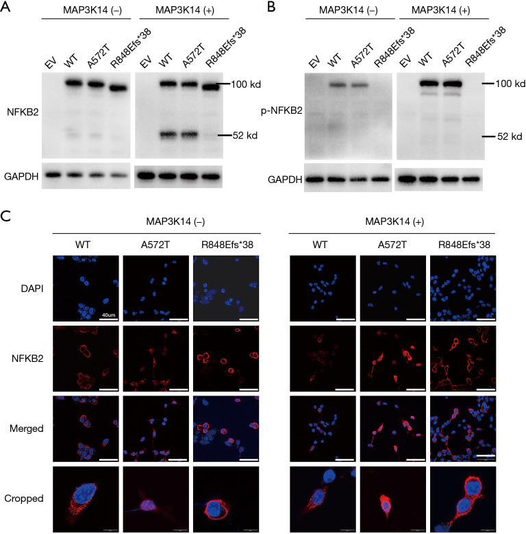 The impact of NF-κB2 mutations on Tfh cell differentiation and their critical role in immune function.