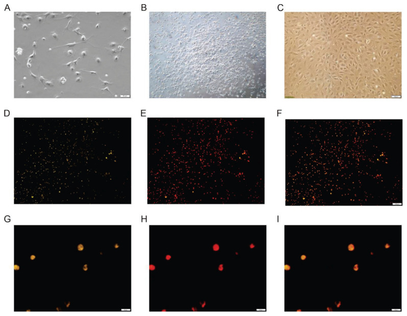 AGEs Inducing EPCs Apoptosis via ROS and p38 MAPK/JNK Pathways in Diabetic Vascular Complications.