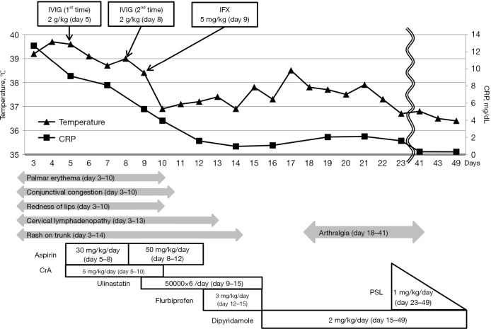 Arthritis associated with Kawasaki disease after initial combination therapy with cyclosporine: a case report.