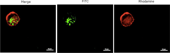 Development of Cell-Derived Plasma Membrane Vesicles as a Nanoparticle Encapsulation and Delivery System.