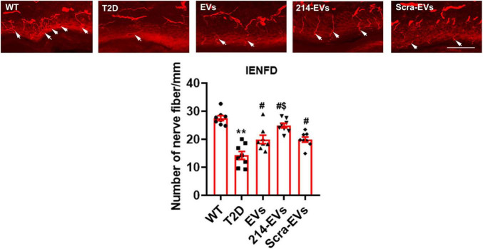 Engineered miR-214 enriched Schwann cell-derived extracellular vesicles amplify therapeutic efficacy for peripheral neuropathy in T2D mice.