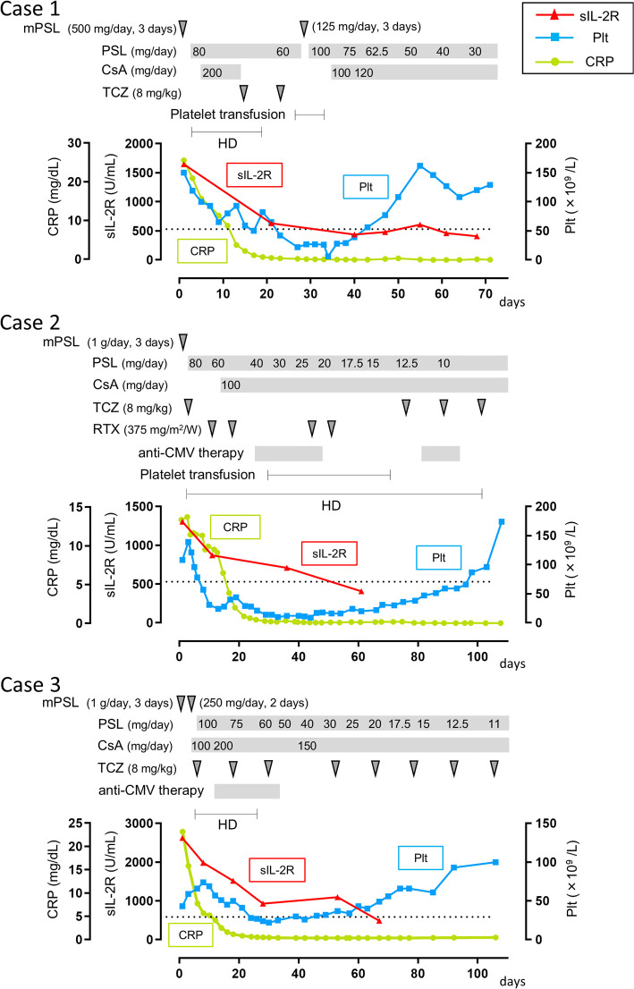 Serum Soluble Interleukin-2 Receptor as a Potential Marker for Assessing Disease Activity in the TAFRO Subtype of Idiopathic Multicentric Castleman Disease.
