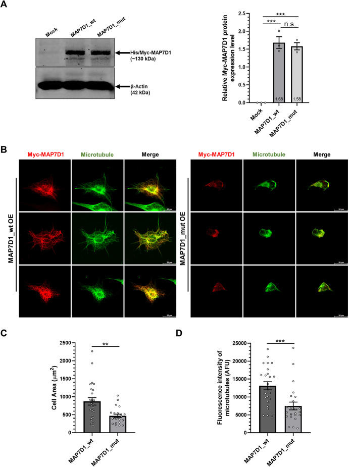 A novel MAP7D1 mutation causes mitotic defects and RPS14 accumulation in Shwachman-Diamond syndrome patient cells.
