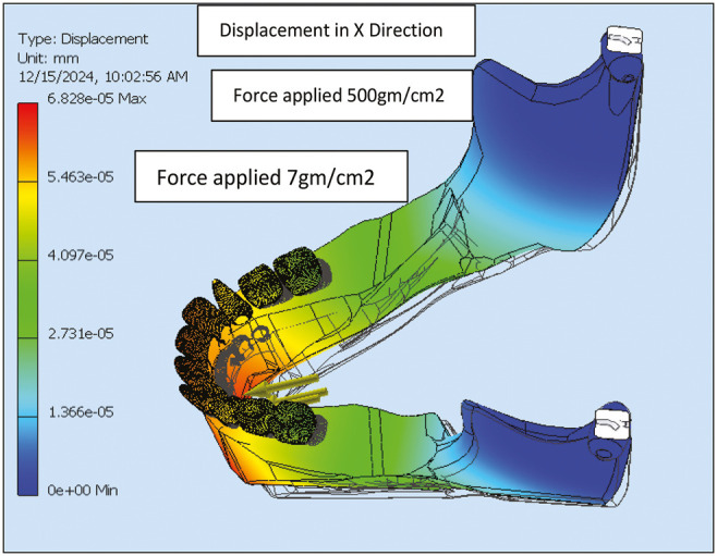 Tongue Behaviors and Their Impact On Mandibular Anterior Structure: A Finite-Element Study.