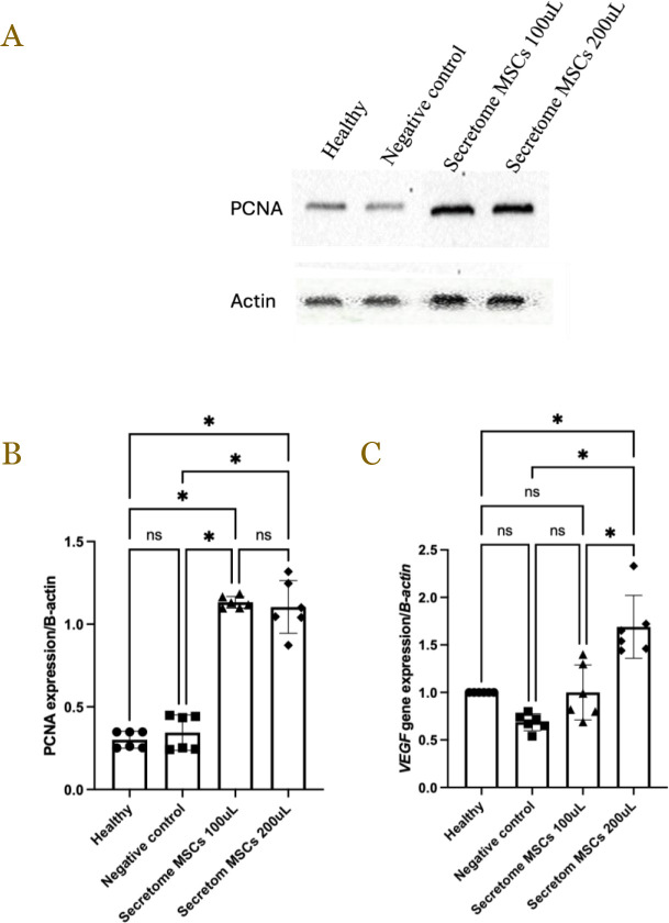 Mesenchymal stem cell-derived secretome accelerates third-degree burn wound healing: Effects on proliferation, angiogenesis, and fibrosis regulation.